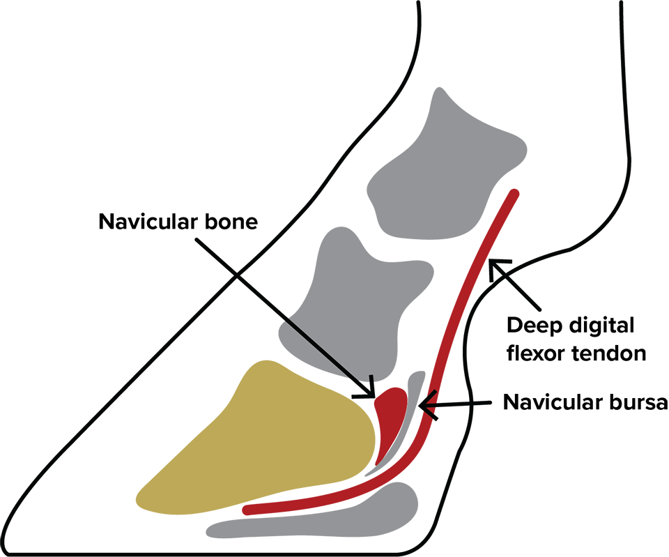 Diagram of navicular bone, deep digital flexor tendon, and navicular bursa of a horse's foot.